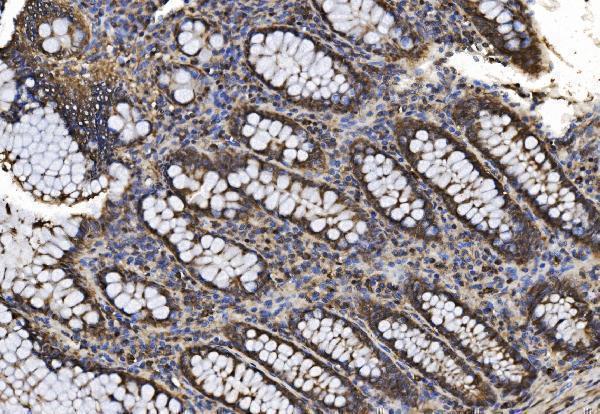 a08095 1 psmb7 primary antibodies ihc testing 7