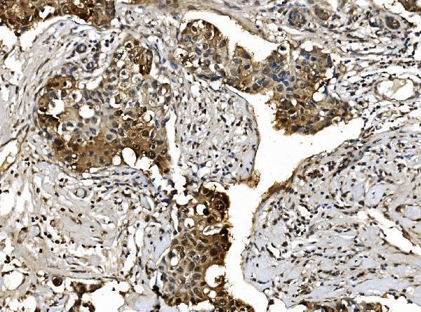 a08095 1 psmb7 primary antibodies ihc testing 8