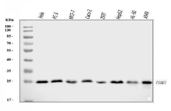  Western blot analysis of Proteasome 20S Beta 7/PSMB7 using anti-Proteasome 20S Beta 7/PSMB7 antibody (A08095-1)