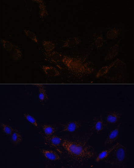 Immunofluorescence analysis of C6 cells using PSMB7 Polyclonal Antibody  at dilution of 1:100 
