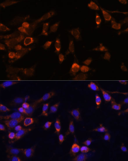Immunofluorescence analysis of NIH-3T3 cells using PSMB7 Polyclonal Antibody  at dilution of 1:100 