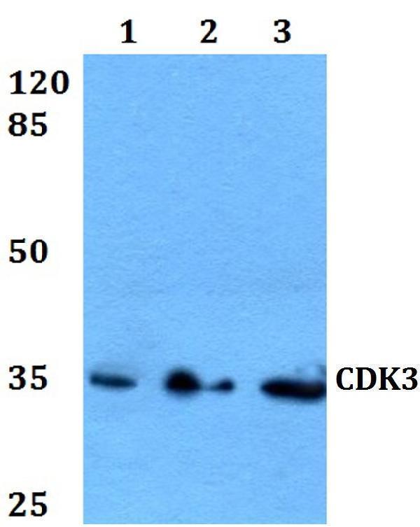 Western blot (WB) analysis of CDK3 polyclonal antibody at 1:500 dilution
Lane1:HEK293T whole cell lysate
Lane2:Raw264
