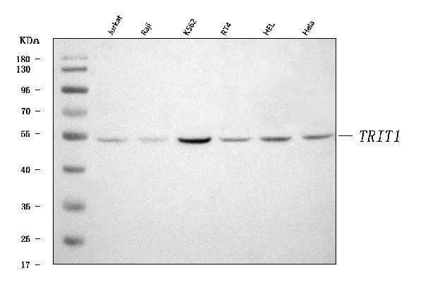  Western blot analysis of IPT/TRIT1 using anti-IPT/TRIT1 antibody (A08098)