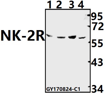 a08100 tacr2 primary antiboties wb testing 1