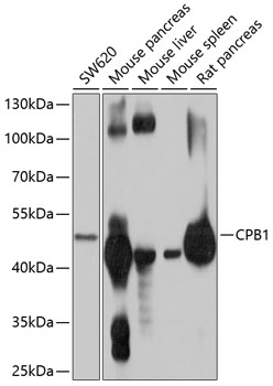 a08101 cpb1 primary antiboties wb testing 1