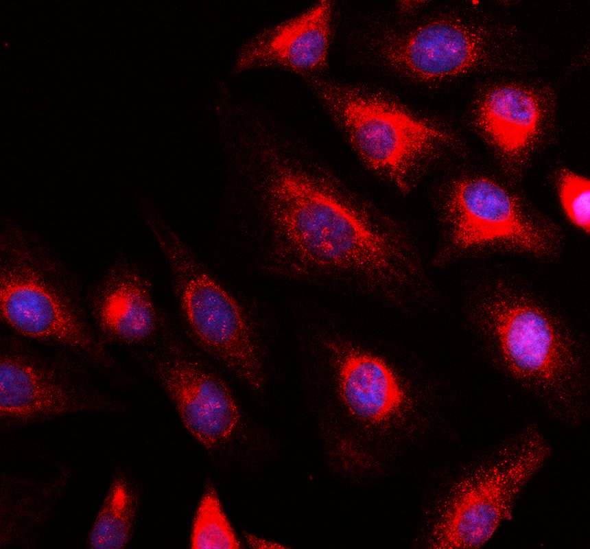 IF analysis of MTX1 using anti-MTX1 antibody (A08106-1)
