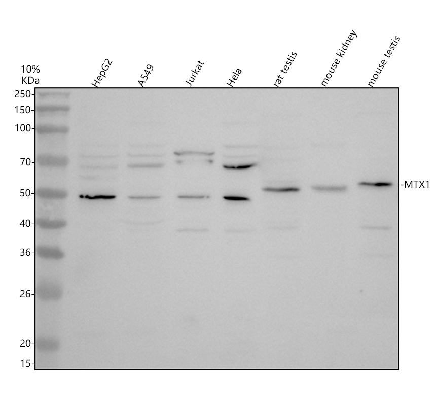 Western blot analysis of MTX1 using anti-MTX1 antibody (A08106-1)