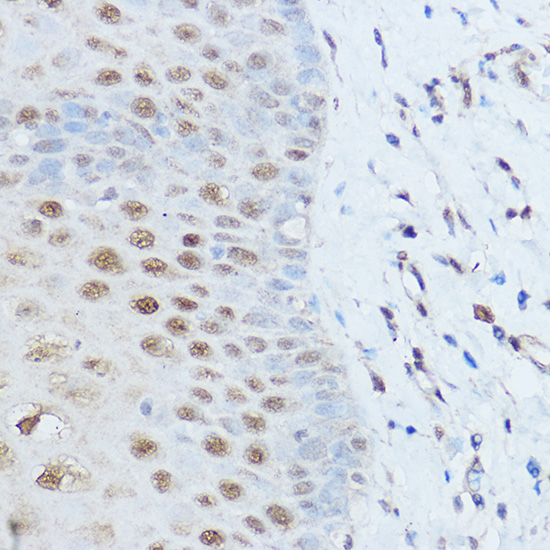 a08109 smarcd2 primary antiboties ihc testing 2