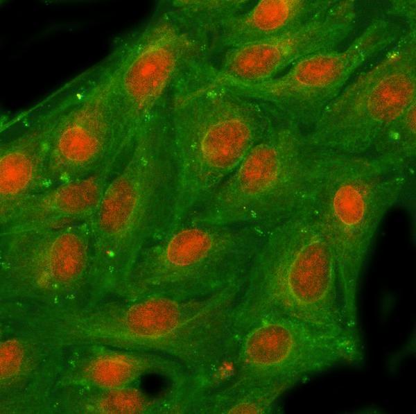  IF analysis of NSFL1C using anti-NSFL1C antibody (A08116-1) and anti-Beta Tubulin antibody (M01857-3)