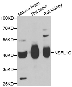 WesternBlot (WB) analysis of NSFL1C polyclonal antibody