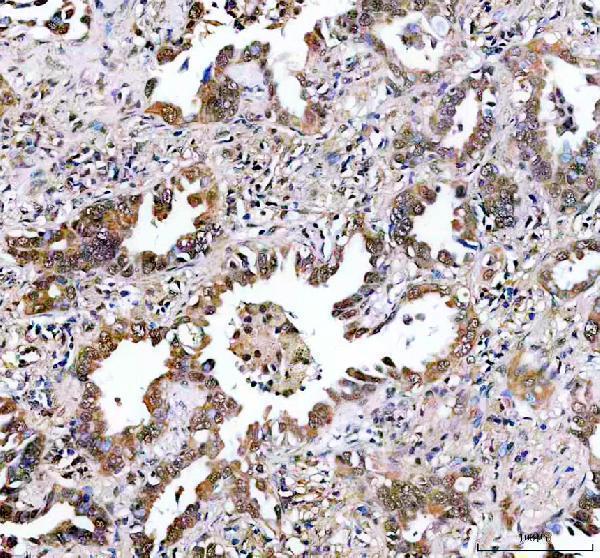IHC analysis of KDM3B using anti-KDM3B antibody (A08117-1)