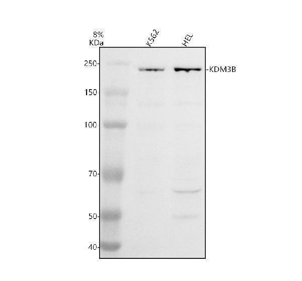 Western blot analysis of KDM3B using anti-KDM3B antibody (A08117-1)