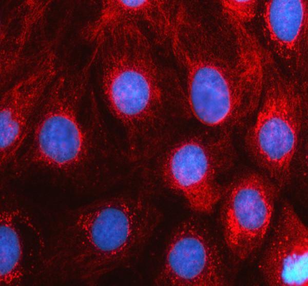 IF analysis of LIPM using anti-LIPM antibody (A08118-1)