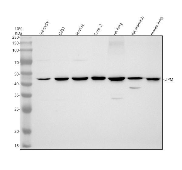 Western blot analysis of LIPM using anti-LIPM antibody (A08118-1)