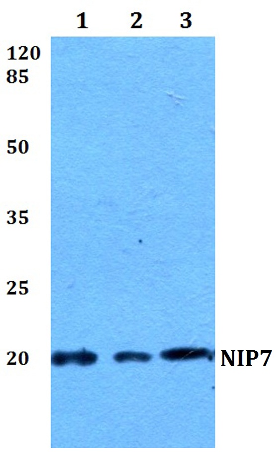a08120 1 nip7 primary antiboties wb testing 1
