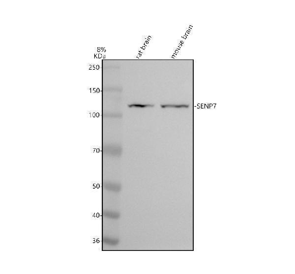 Western blot analysis of SENP7 using anti-SENP7 antibody (A08121-3)