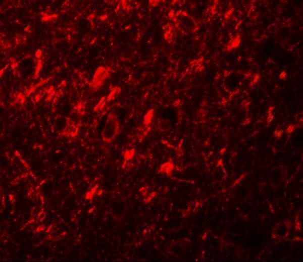 Immunofluorescence of NALP10 in human brain tissue with NALP10 antibody at 20 μg/mL