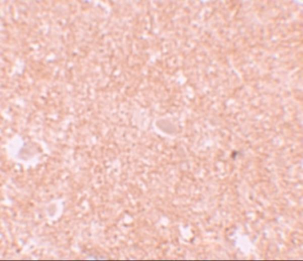 Immunohistochemistry of NALP10 in human brain tissue with NALP10 antibody at 10 μg/mL