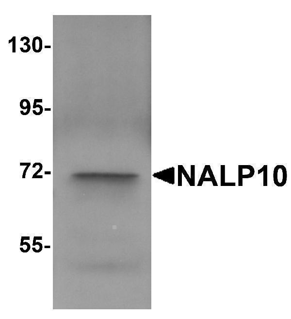 Western blot analysis of NALP10 in human brain tissue lysate with NALP10 antibody at 1 μg/mL