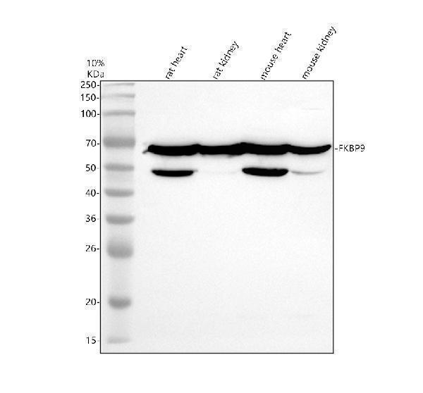 Western blot analysis of FKBP9 using anti-FKBP9 antibody (A08125-1)