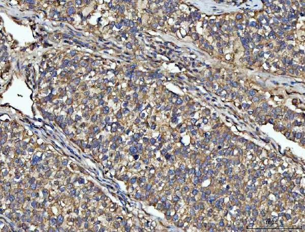  IHC analysis of NPEPPS using anti-NPEPPS antibody (A08129-2)