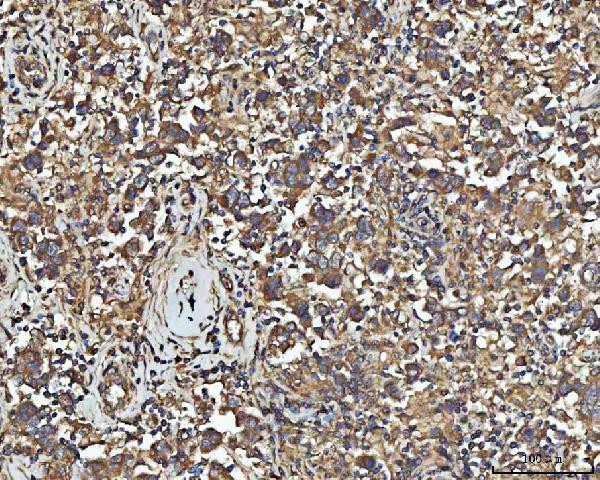  IHC analysis of NPEPPS using anti-NPEPPS antibody (A08129-2)