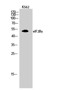Western Blot analysis of K562 cells using eIF2Bγ Polyclonal Antibody diluted at 1:1000