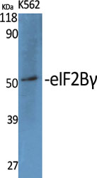 Western Blot analysis of various cells using eIF2Bγ Polyclonal Antibody diluted at 1:1000