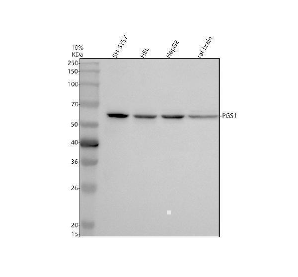 Western blot analysis of PGS1 using anti-PGS1 antibody (A08135)