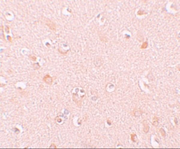 a08138 nlrp5 primary antibodies ihc testing 2