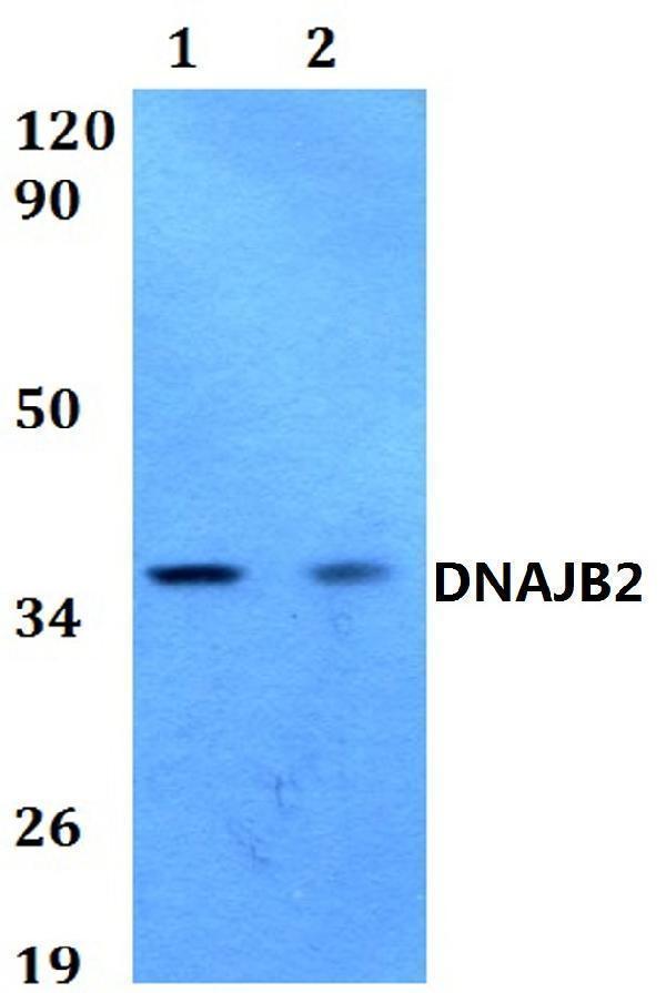 Western blot (WB) analysis of DNAJB2 polyclonal antibody at 1:500 dilution
Lane1:HEK293T whole cell lysate
Lane2:PC12 whole cell lysate 