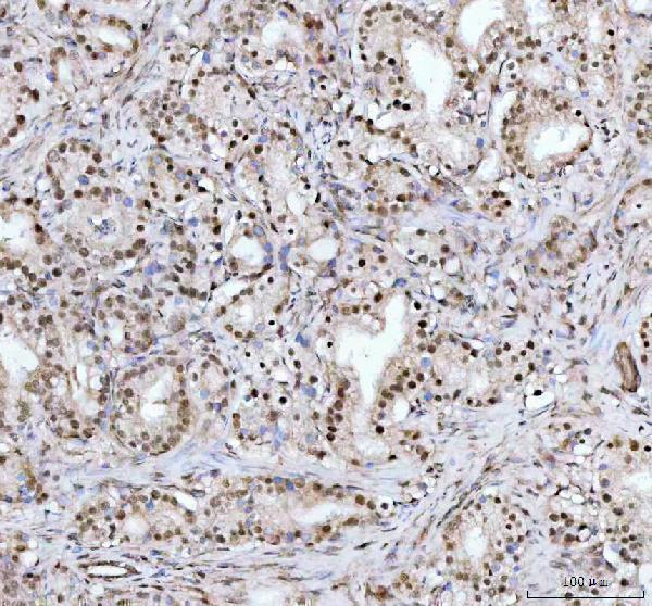 a08140 1 dhx15 primary antibodies ihc testing 2_1