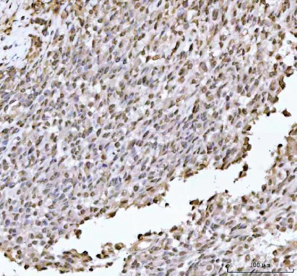a08140 1 dhx15 primary antibodies ihc testing 3_1