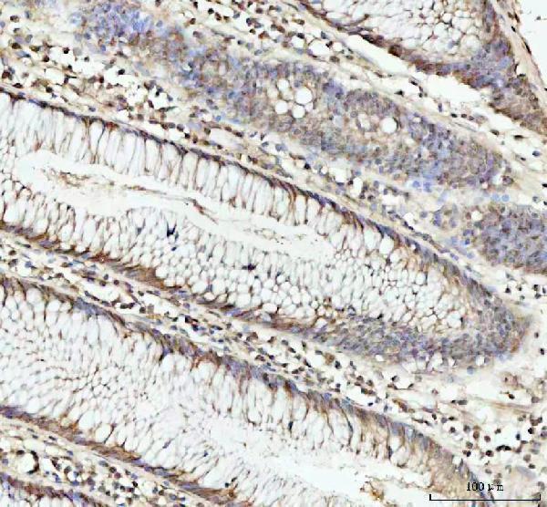 a08140 1 dhx15 primary antibodies ihc testing 4_1