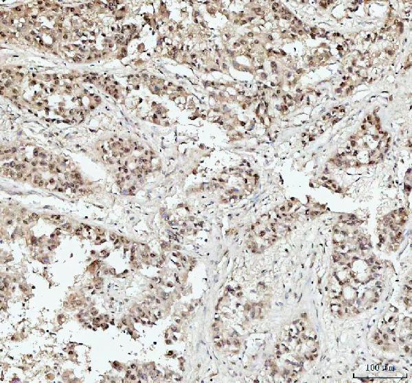 a08140 1 dhx15 primary antibodies ihc testing 5_1
