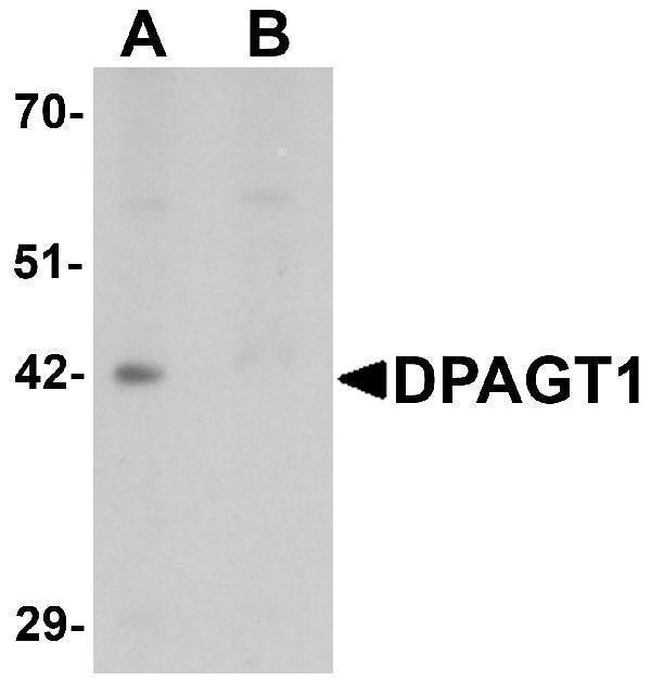 Western blot analysis of DPAGT1 in mouse kidney tissue lysate with DPAGT1 antibody at 1 μg/mL in (A) the absence and (B) the presence of blocking peptide