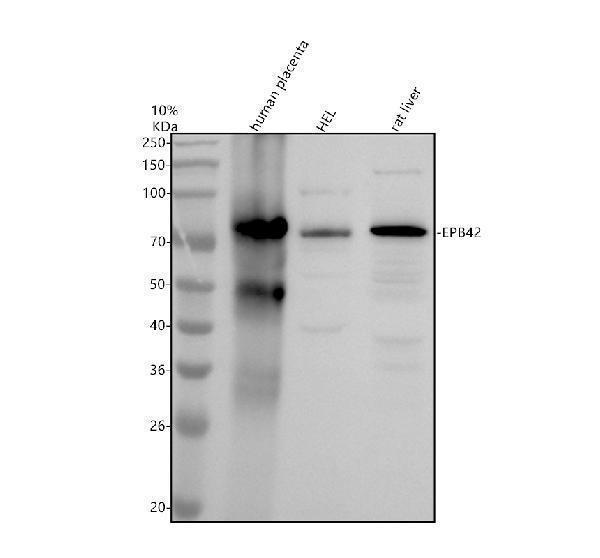 Western blot analysis of EPB42 using anti-EPB42 antibody (A08148-1)