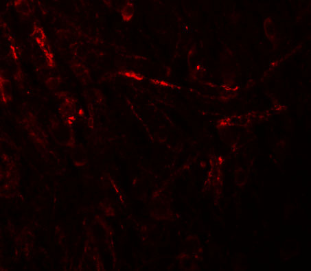 a08155 zbtb4 primary antibodies if testing 3