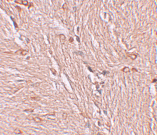 a08155 zbtb4 primary antibodies ihc testing 2