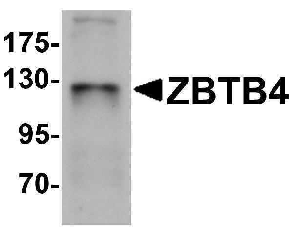 a08155 zbtb4 primary antibodies wb testing 1