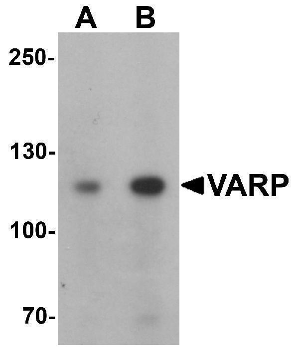 a08157 1 ankrd27 primary antibodies wb testing 1
