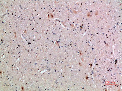 Immunohistochemical analysis of paraffin-embedded human-brain, antibody was diluted at 1:200