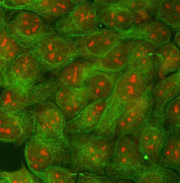  IF analysis of RRP1B and Tubulin beta using anti-RRP1B antibody (A08159-1) and anti-Tubulin beta antibody (M05613-4)