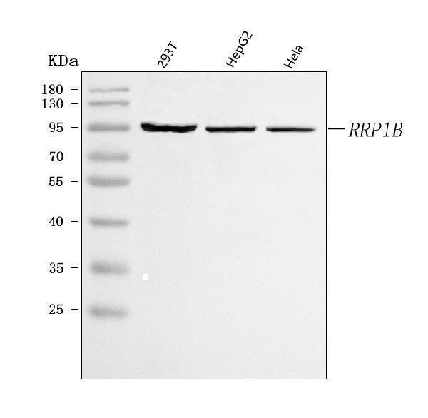  Western blot analysis of RRP1B using anti-RRP1B antibody (A08159-1)