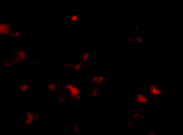 Immunofluorescence of JPH3 in Human Brain cells with JPH3 antibody at 20 μg/mL