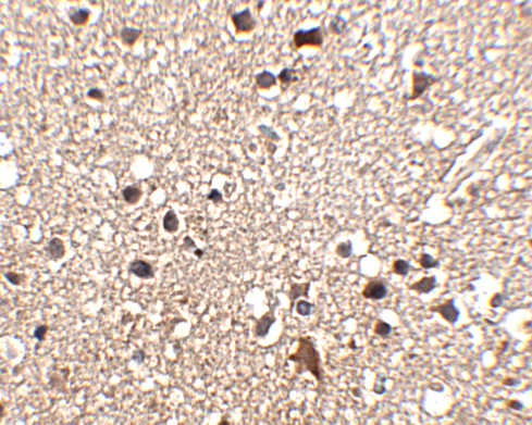 Immunohistochemistry of JPH3 in human brain tissue with JPH3 antibody at 2