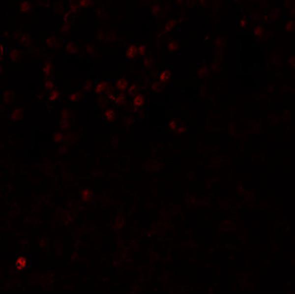 Immunofluorescence of LMBRD1 in human brain tissue with LMBRD1 antibody at 20 μg/mL