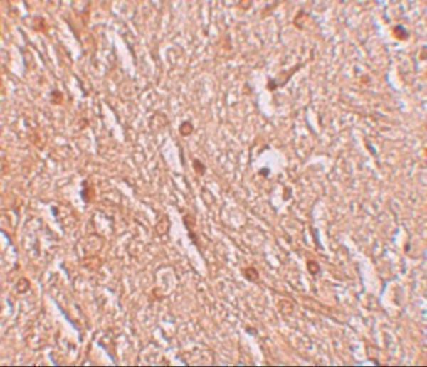 Immunohistochemistry of LMBRD1 in human brain tissue with LMBRD1 antibody at 2