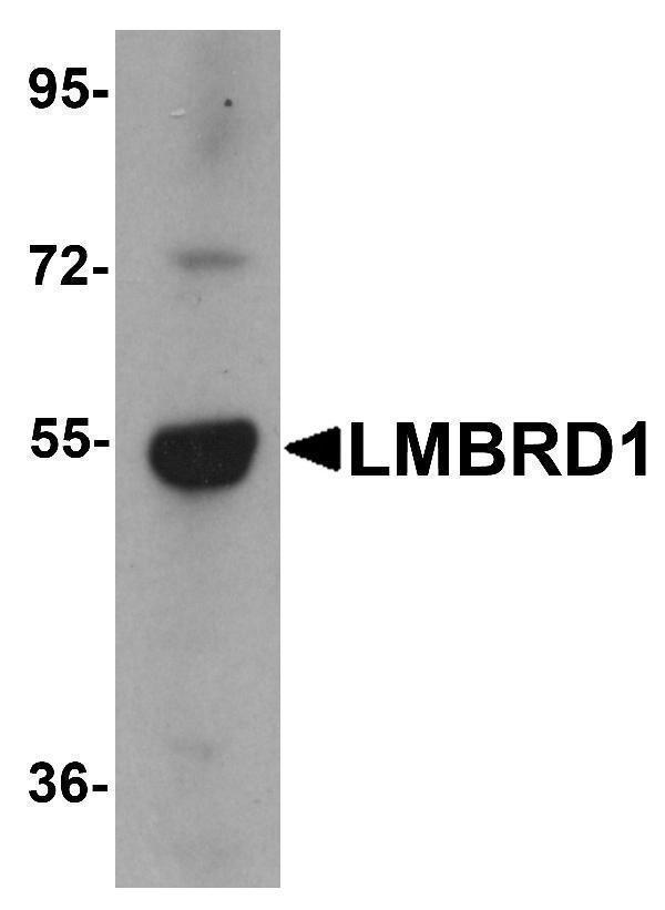 Western blot analysis of LMBRD1 in human brain tissue lysate with LMBRD1 antibody at 1 μg/mL