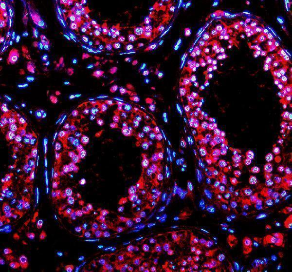 a08165 2 fzd9 primary antibodies if testing 2